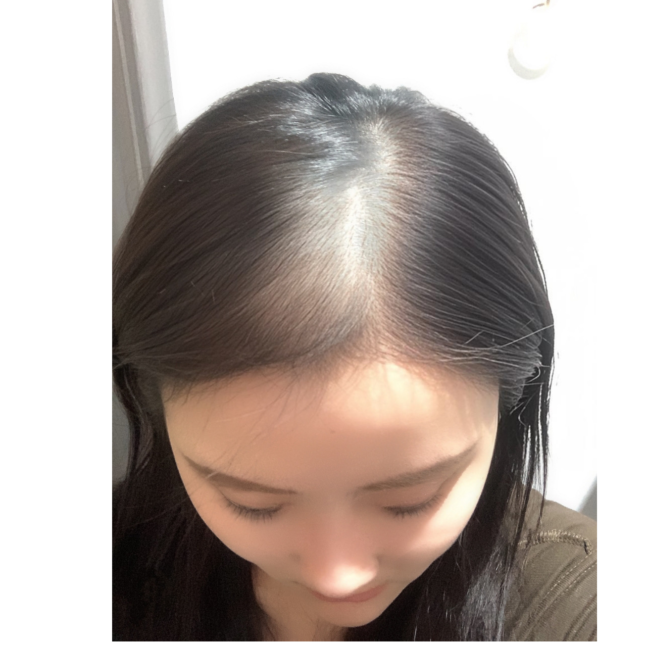 星星产后脱发照片梳