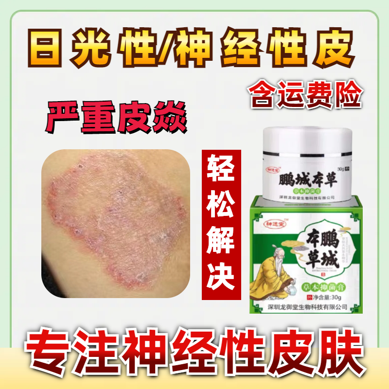 卓延堂鹏城本草抑菌乳膏神经性皮肤止痒膏日光性过角敏化皮肤瘙痒