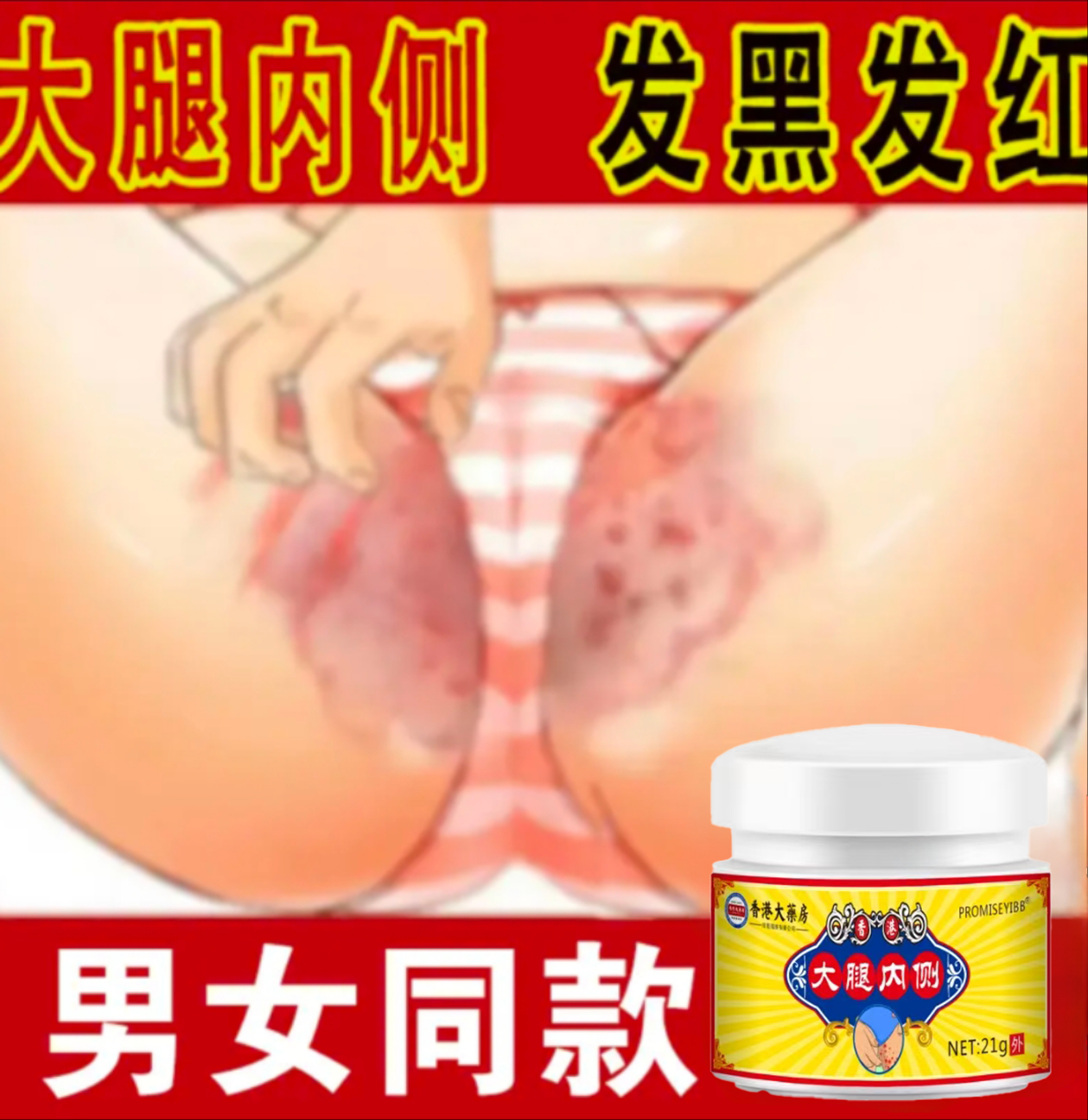 男女通用大腿内侧好痒越抓越痒潮~湿红~肿~异味痒外用止痒软膏