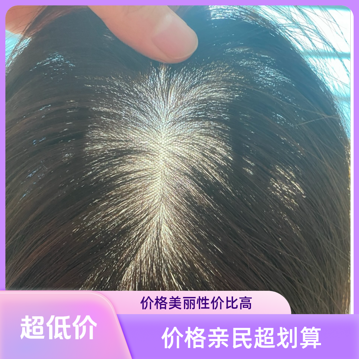 9*14补发片女真人发增发天然真发遮白发不用戴发网真发假发片