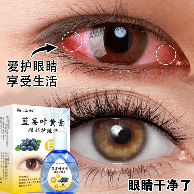 叶黄素滴眼液明目护眼眼部清洁护理液眼干眼清洗涩缓解疲劳舒缓液