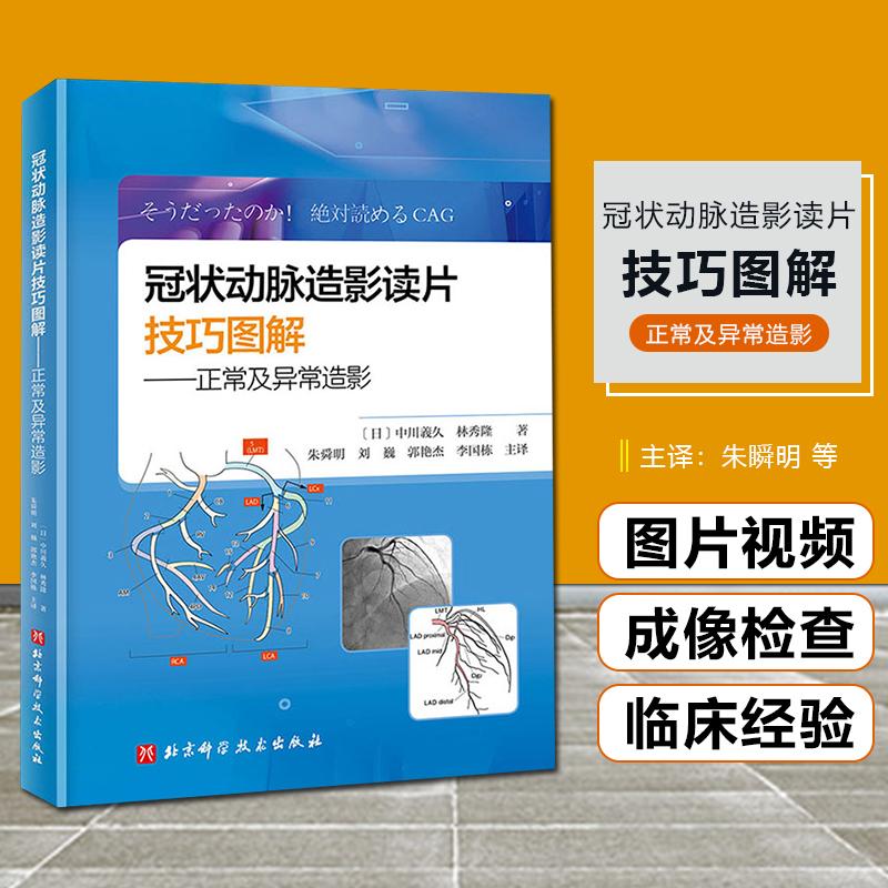 冠状动脉造影读片技巧图解正常及异常造影9787571419929北京科技