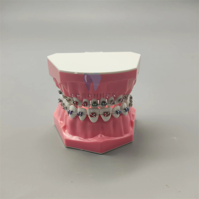 牙科正畸口腔带托槽假牙模型 医患托槽沟通教学矫正练习7010
