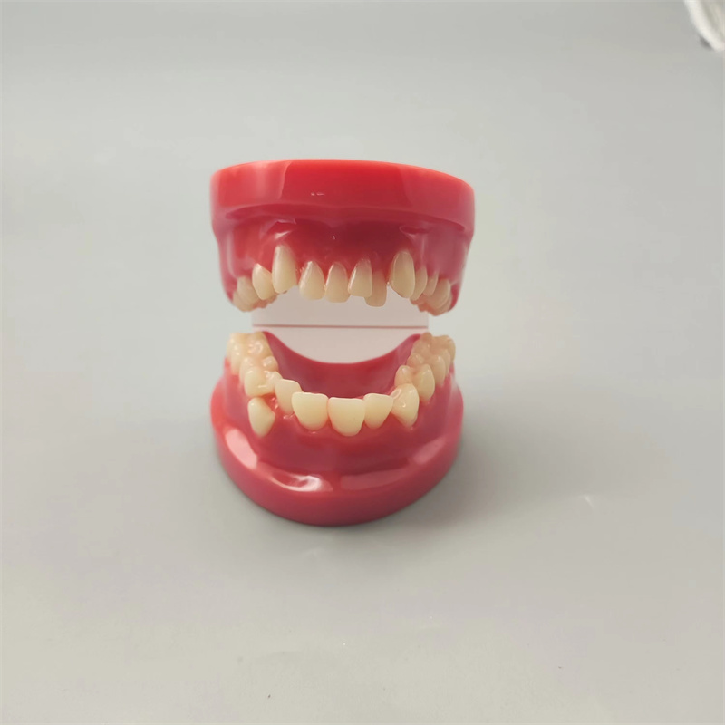 牙科口腔正畸模型B4红色错颌展示模型假牙道具齿科医患沟通