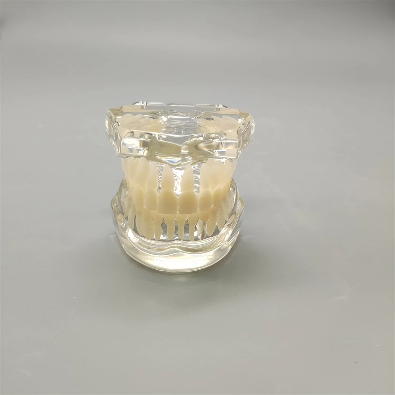 牙模树脂教学水晶透明综合沟通种植牙齿B7模型包邮医患成人病理