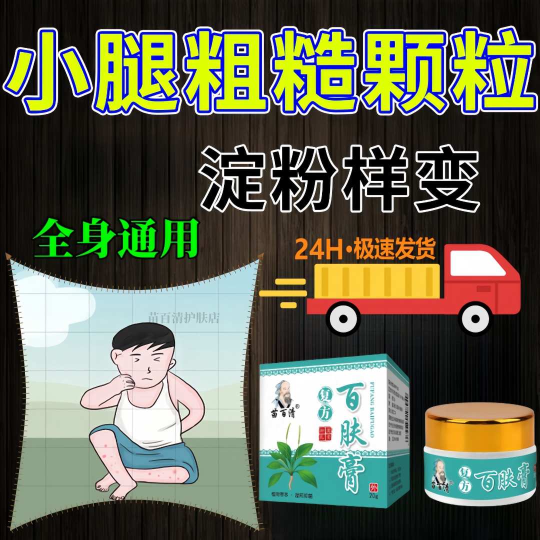 皮肤淀粉样变粗糙沉积成人老人儿童外用乳膏皮肤身体通用草本乳膏