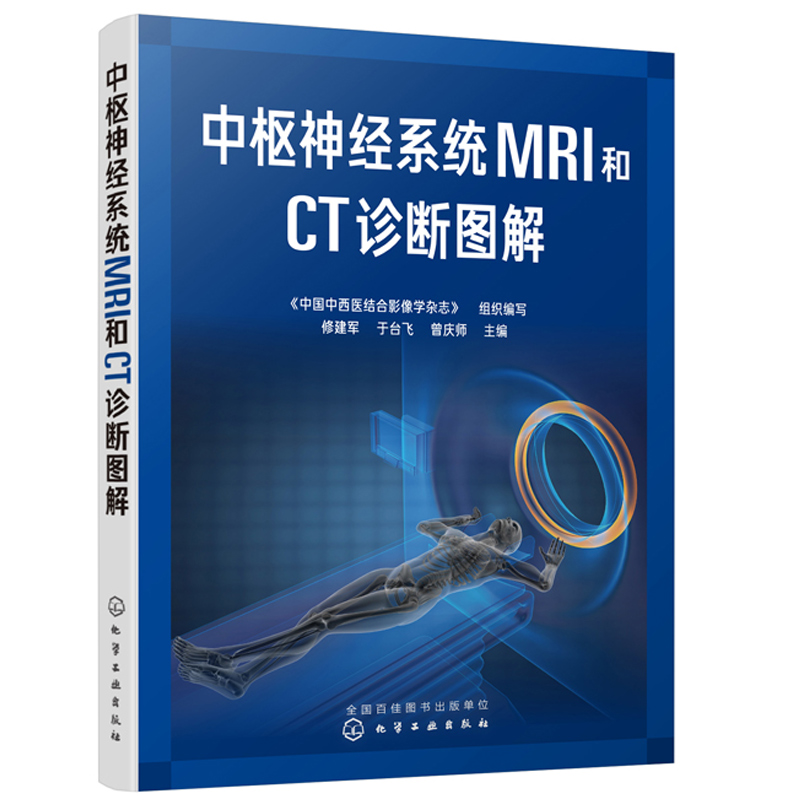 中枢神经系统MRI和CT诊断图解先天性疾病颅脑损伤脑卒中血管性病