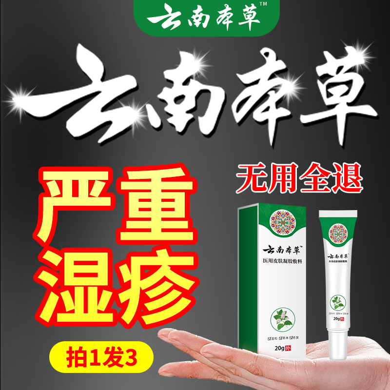 湿疹痒牛皮荨麻银屑皮肤通用止痒膏全身红诊手足脚痒顽固性汗斑