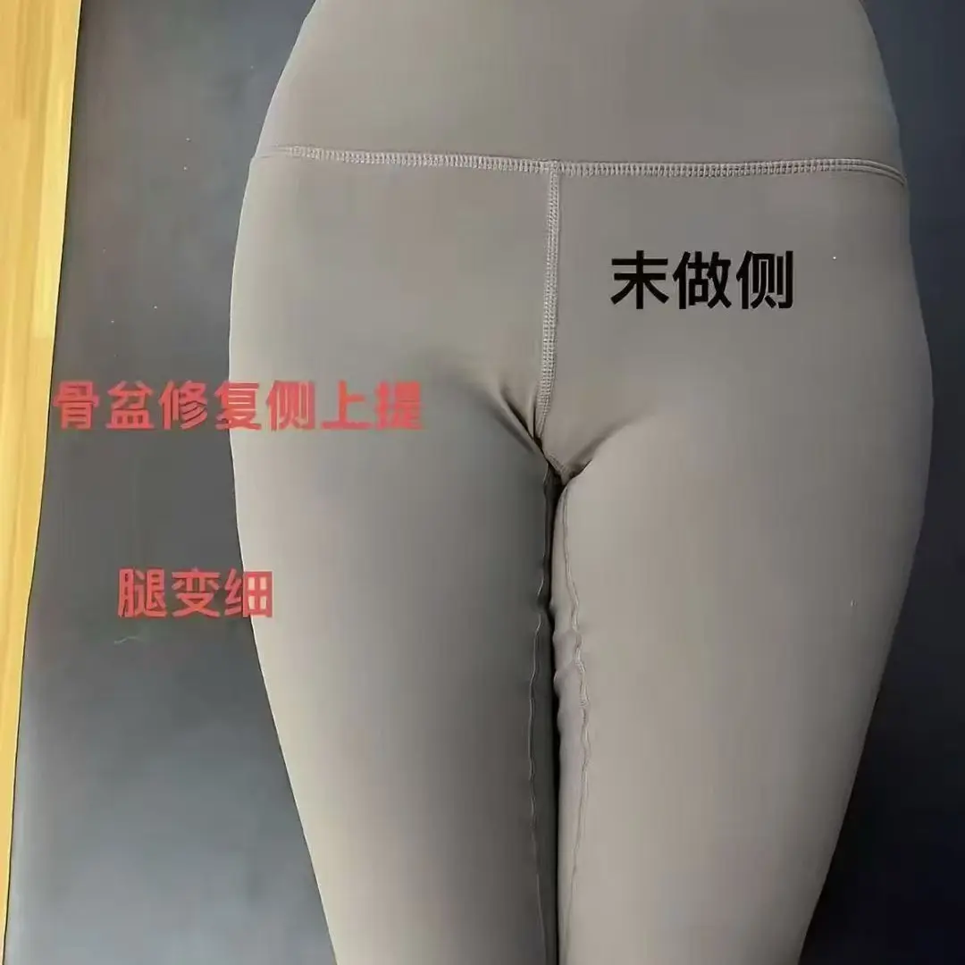 盆骨修复+腹直肌+耻骨