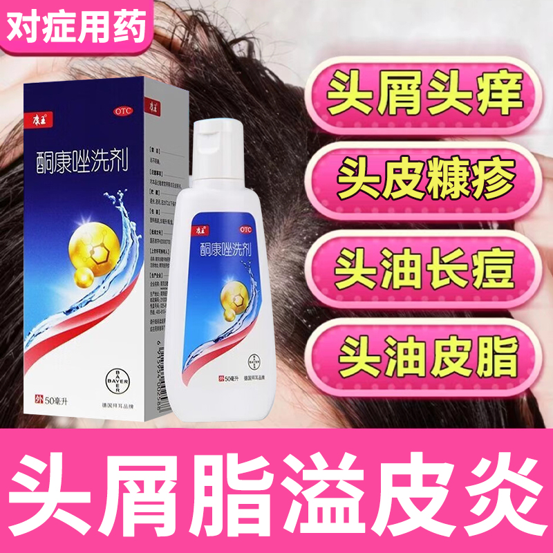 康王酮康唑洗剂2%*50ml 治疗脂溢性皮炎瘙痒头皮屑去屑止痒洗发剂
