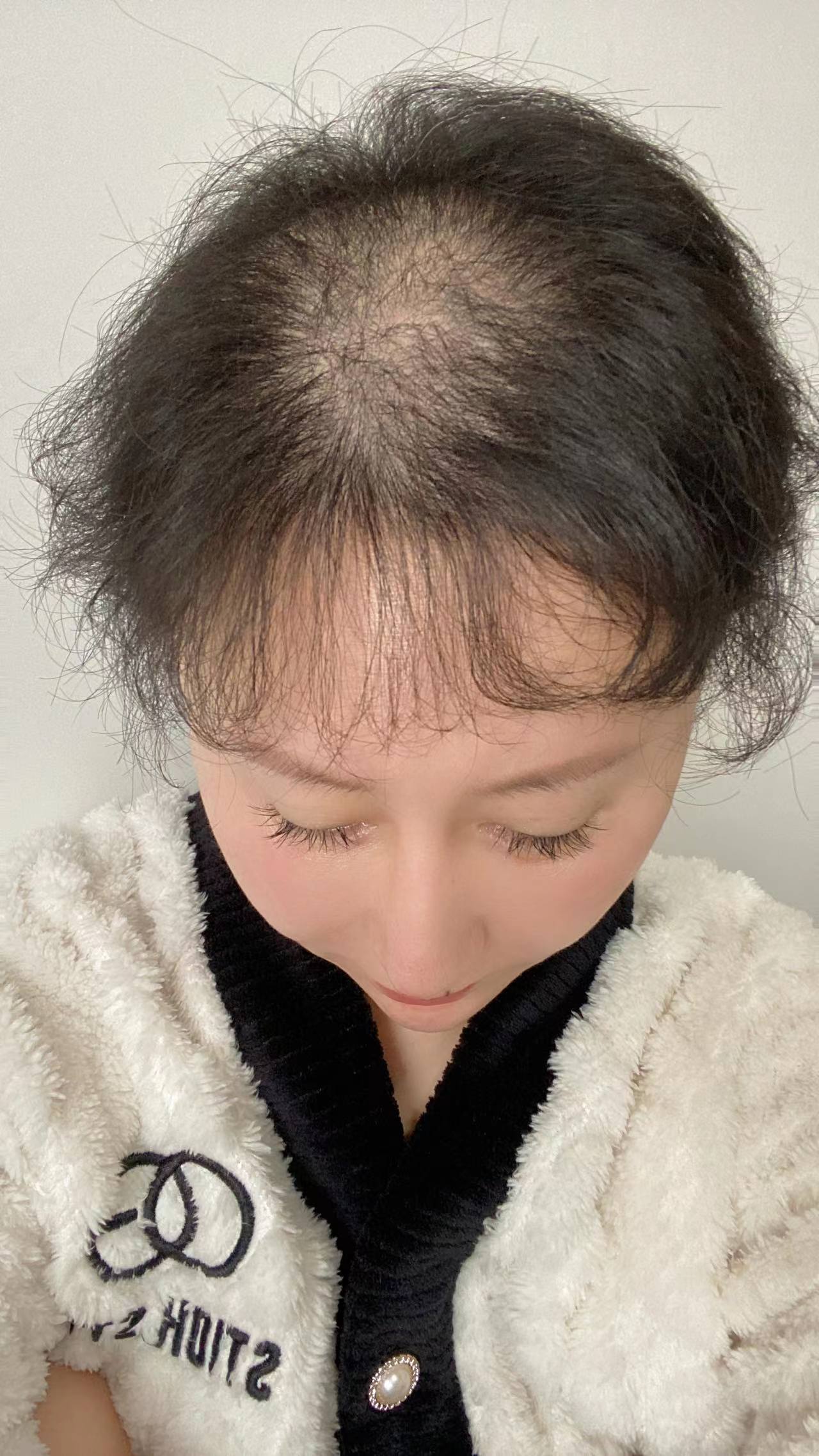 主播使用精华液前